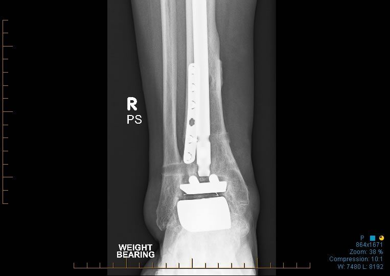 Dr Yeo Brisbane Foot & Ankle Surgeon