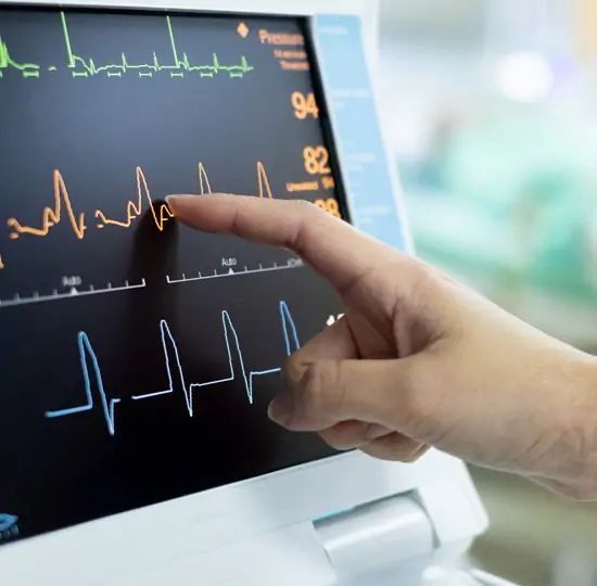 Hand pointing at a vital signs monitor displaying heart rhythms in an operating room.