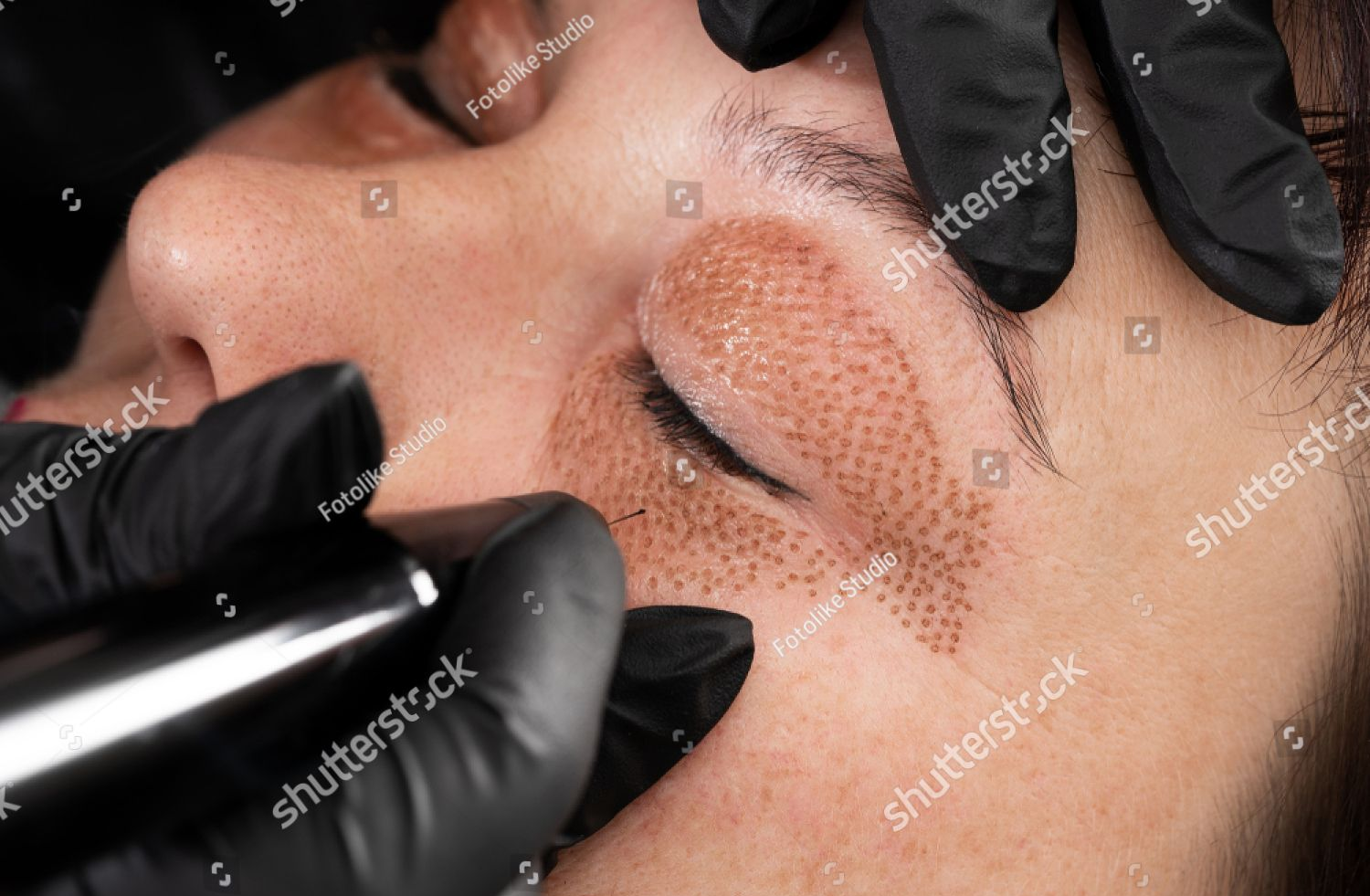 Gloved hands applying a brow treatment to a person lying face up