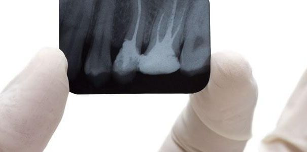 DRA. ELIZABETH GONZÁLEZ ENDODONCIA INTEGRAL - Diagnóstico integral