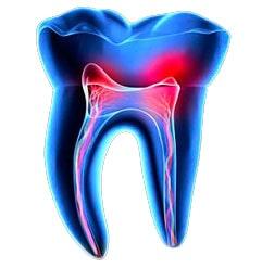 DRA. ELIZABETH GONZÁLEZ ENDODONCIA INTEGRAL - Endodoncia