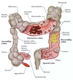 Large Intestine Anatomy Large Intestine Anatomy