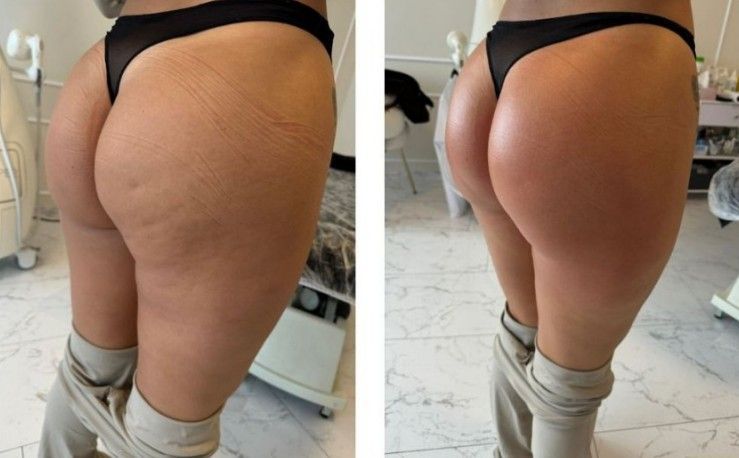 Before and after