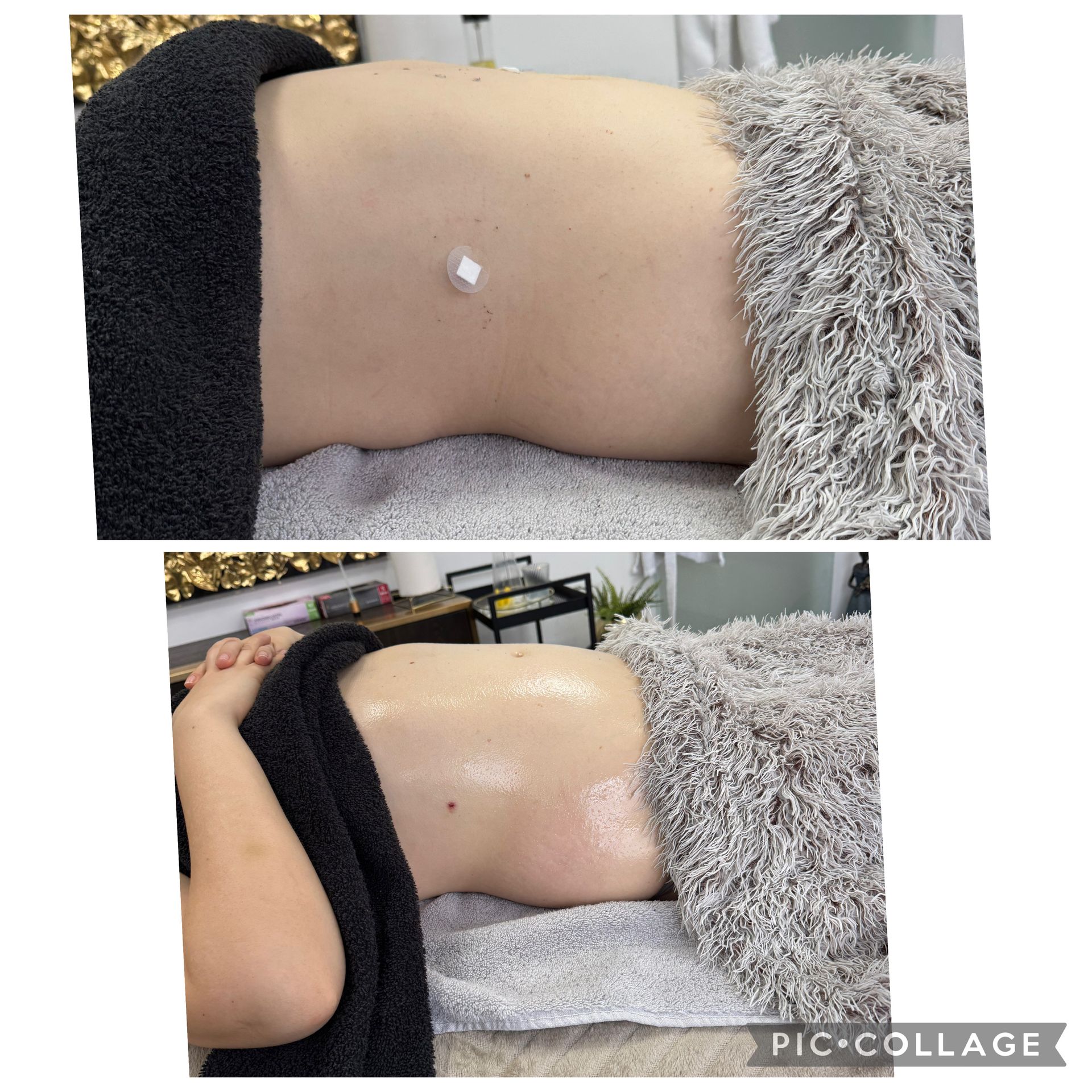 Eine Person liegt auf einem Bett; ihr Bauch ist mit glänzender Lotion bedeckt und trägt einen kleinen weißen Klebefleck.