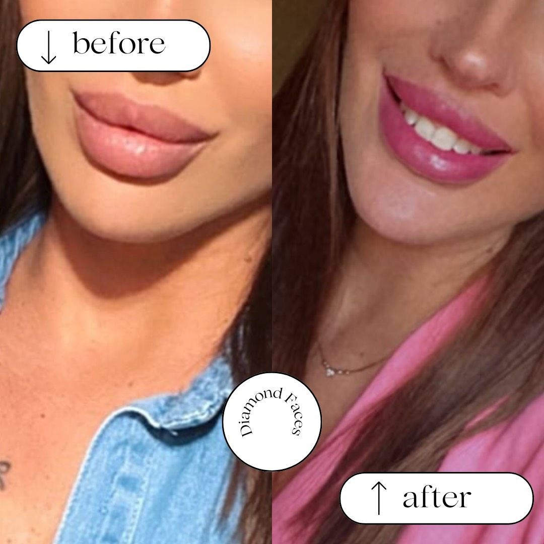 Vorher-Nachher-Nahaufnahme der Lippen: vorher mattes Nude, danach glänzendes Rosa.