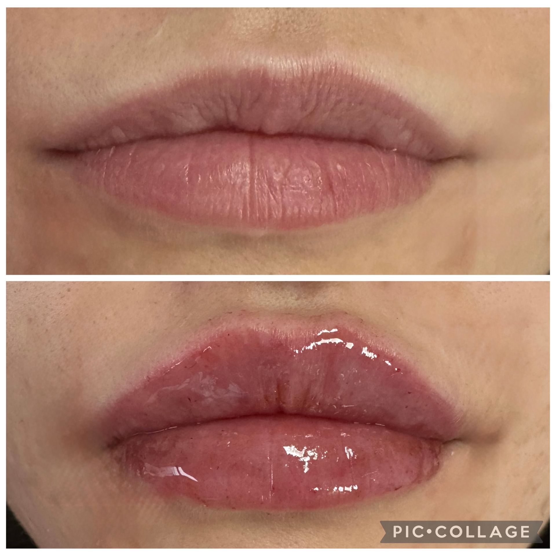 Zwei Nahaufnahmen der Lippen: oben natürliche Lippen und unten glänzender, dunkelvioletter Lippenstift aufgetragen.