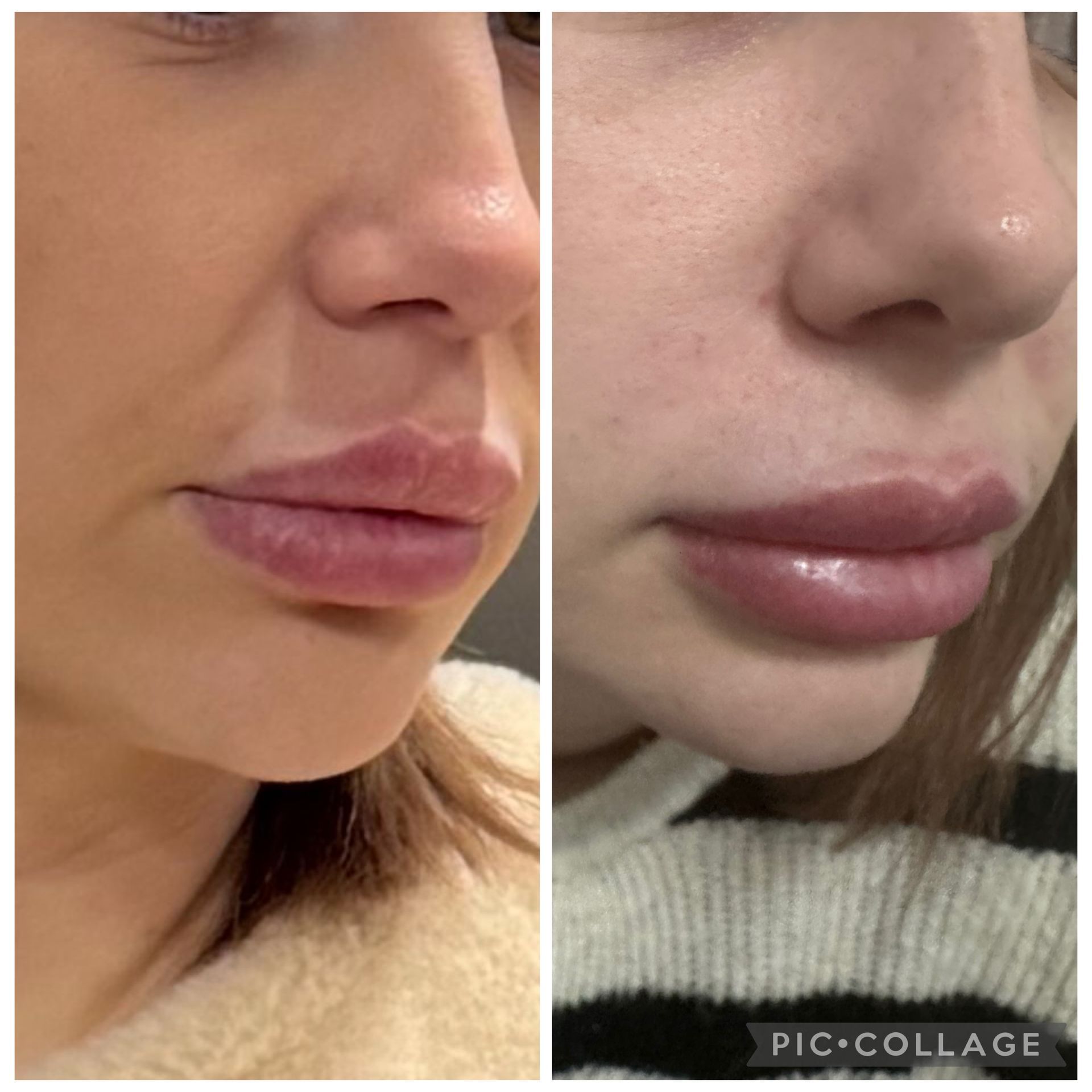 Nahaufnahmen im direkten Vergleich der unteren Gesichtshälfte einer Person, die die Lippen vor und nach dem Auftragen von Lipgloss zeigt, sowie eines Nasenpiercings.