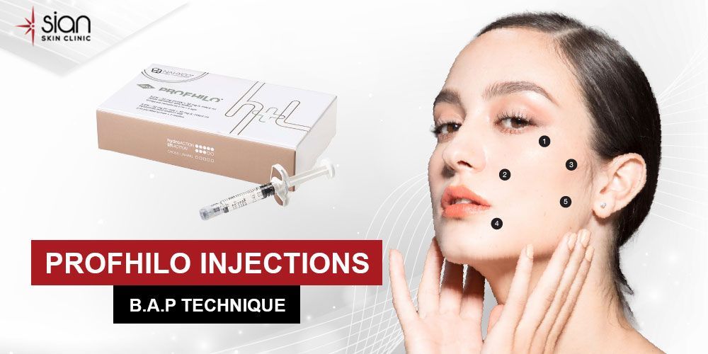 PROFHILO INJECTOINS Werbebox und Frau berührt Wange mit Gesichtsmarkierungspunkten
