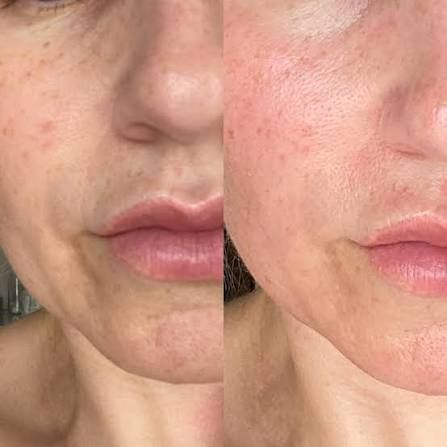 Nahaufnahme zweier nebeneinanderliegender Gesichter mit sichtbarer Hautstruktur und natürlichen Lippen