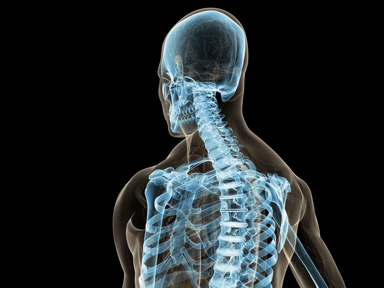 3D medical illustration of a human upper back and skull with blue spine and rib cage visible