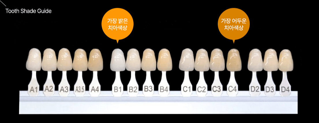 PROFESSIONAL TEETH WHITENING IN GANGNAM – ACHIEVE A BRIGHTER, WHITER SMILE