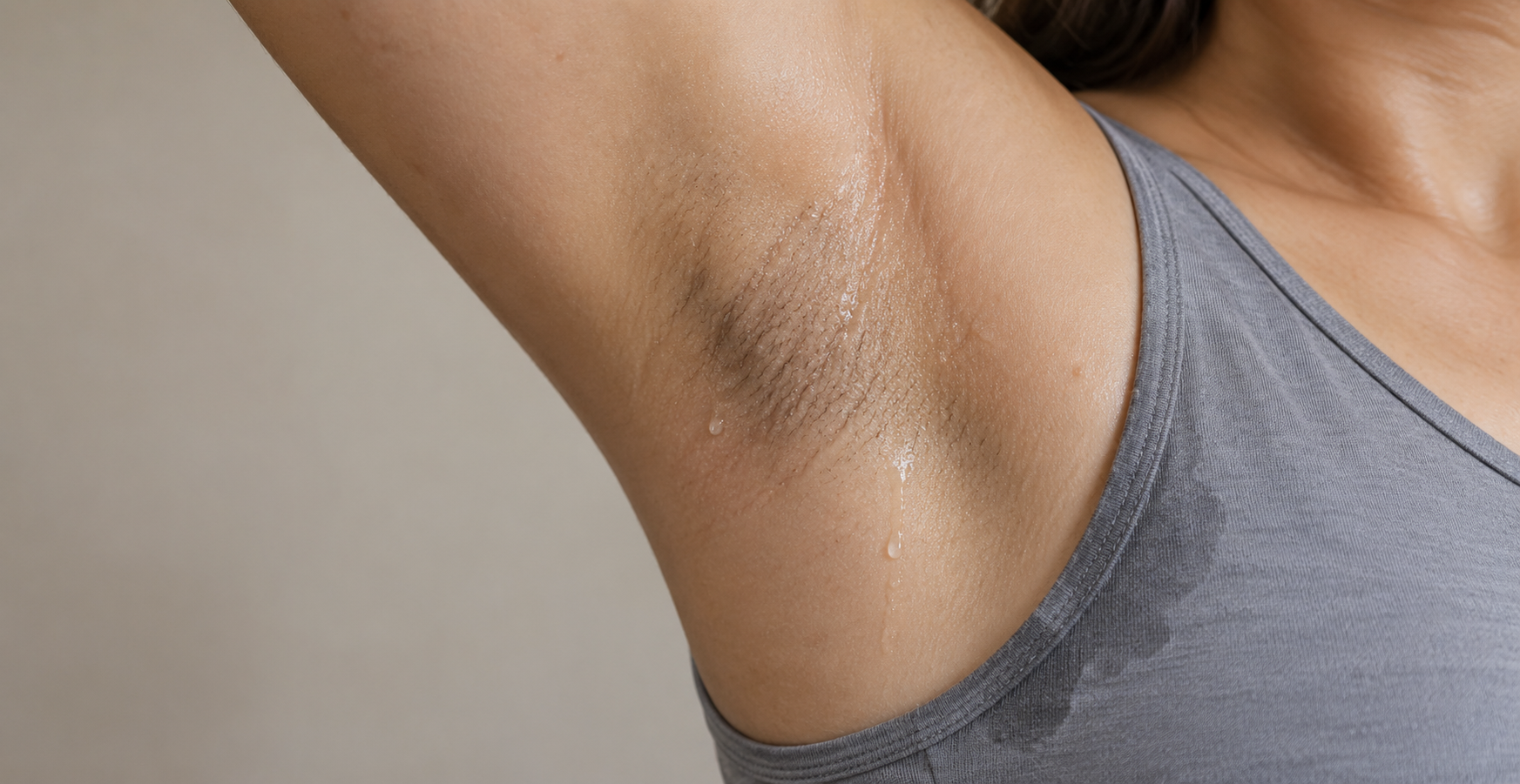 Visible underarm perspiration showing excessive sweating