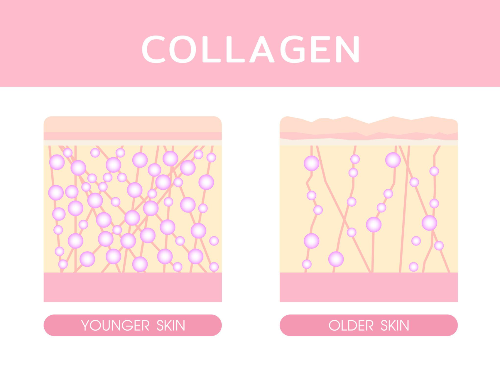 Diagram comparing the dense collagen network in younger skin with the sparse, broken network in older skin