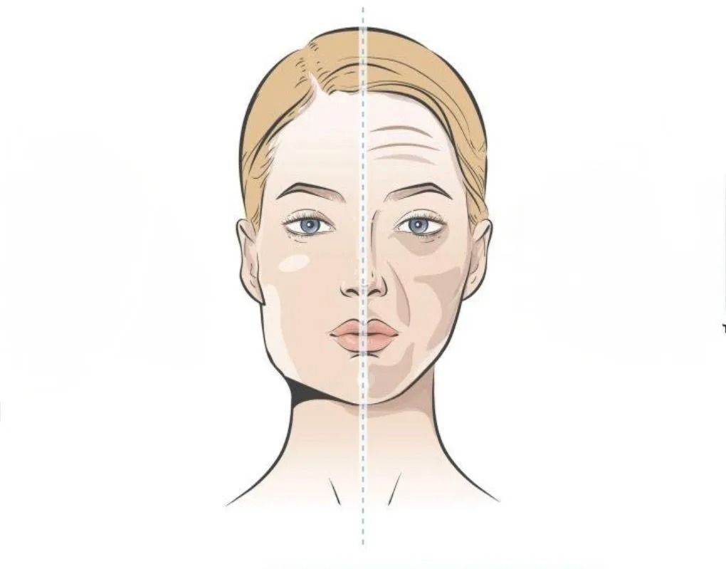 Facial volume loss after weight loss before and after skin tightening