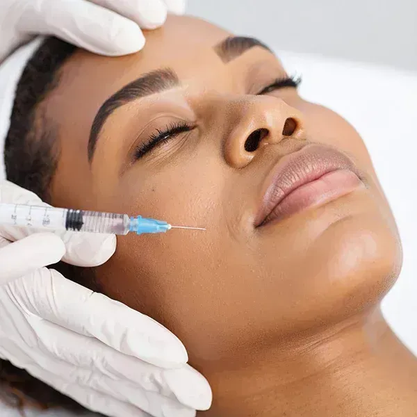 Biostimulator injection to the cheek at Good Skin Aesthetics in Loomis, California