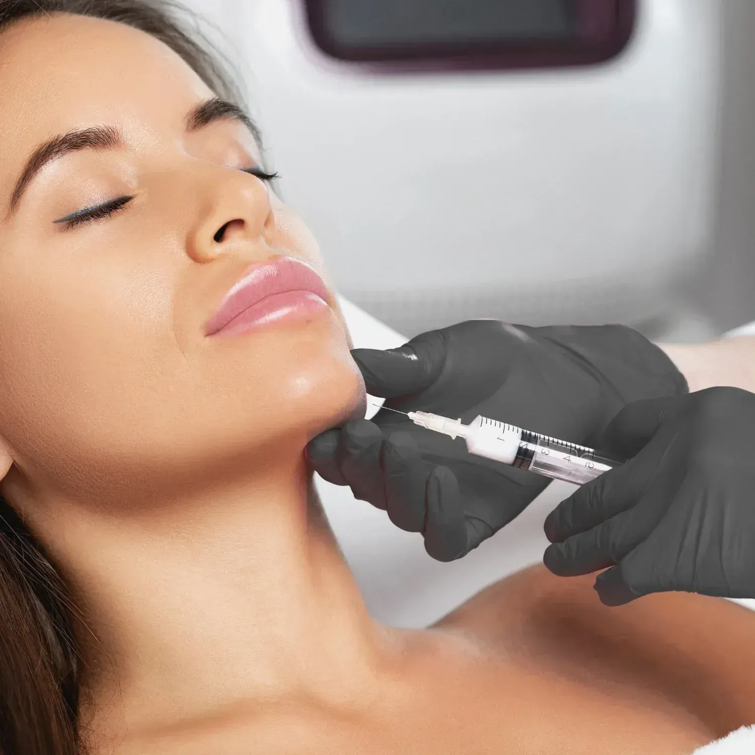 Biostimulator injection to the chin at Good Skin Aesthetics in Loomis, California