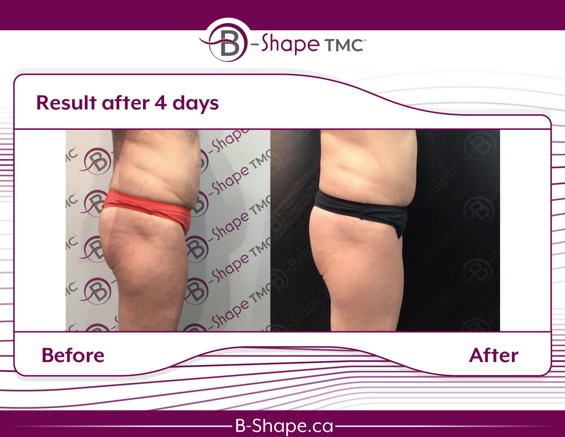 Our Treatment: What It Does | B-Shape T.M.C.