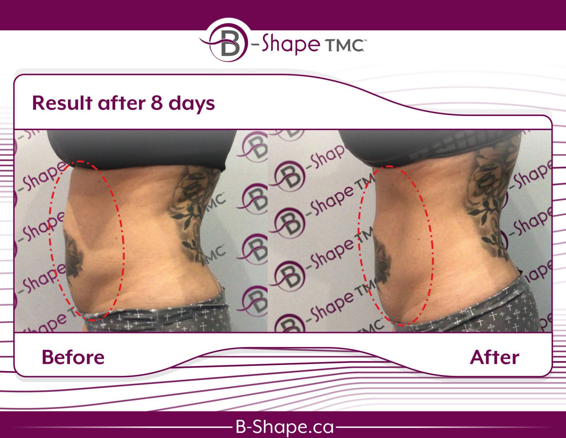 Side-by-side abdomen photos. 