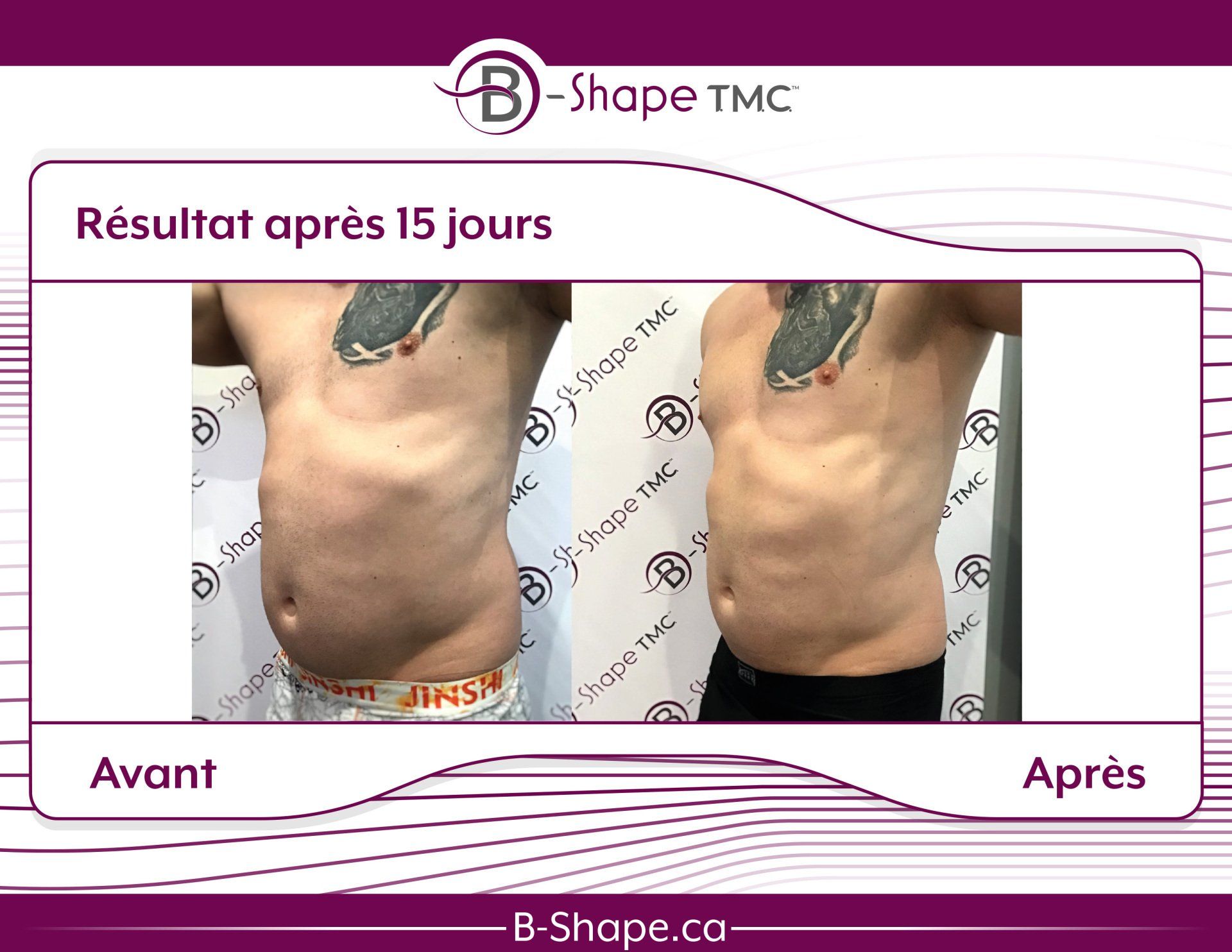 Photos avant/après du torse d'un homme après 15 jours. Réduction significative de la graisse abdominale.