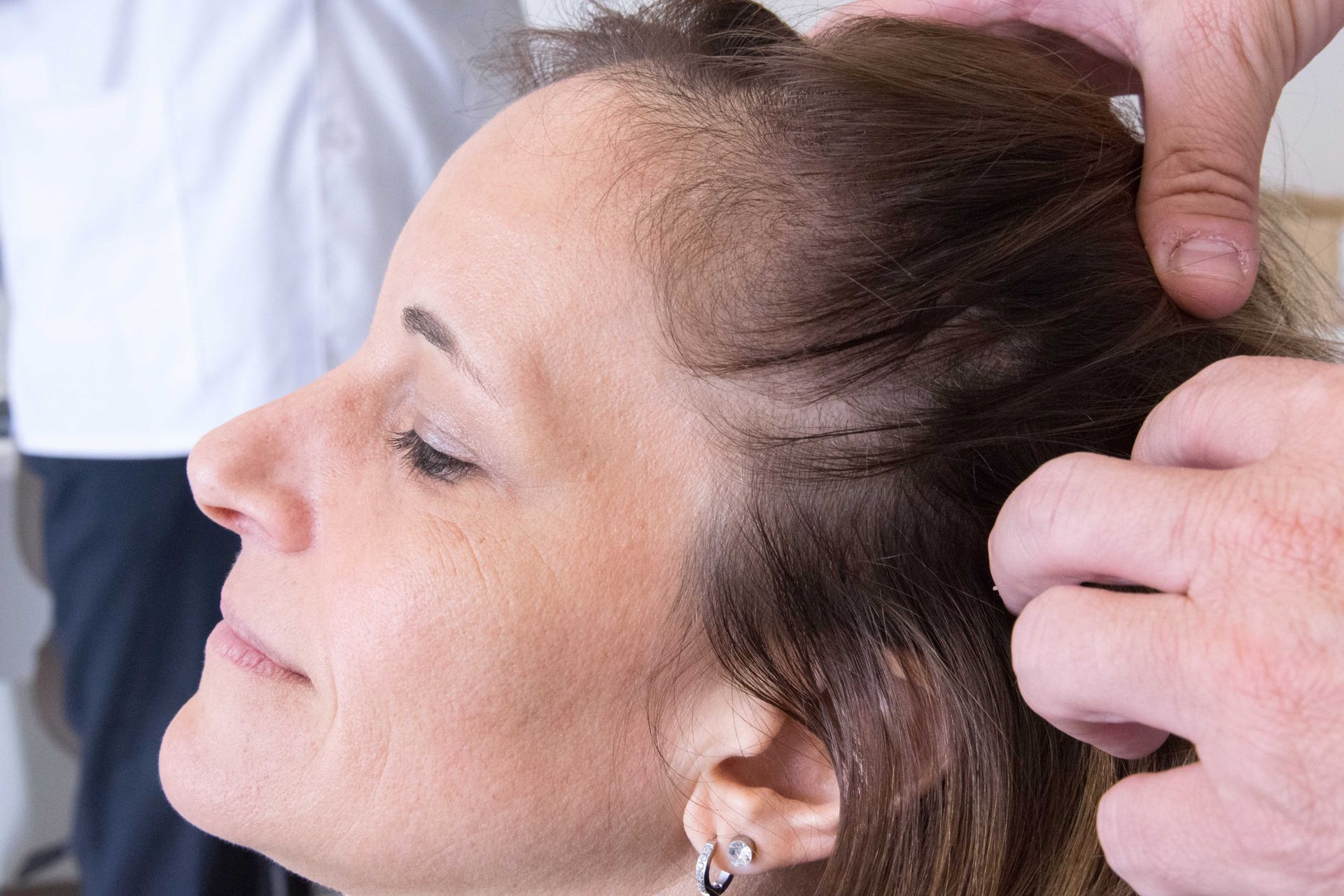 A practitioner gently parts a person's hair to examine their scalp.