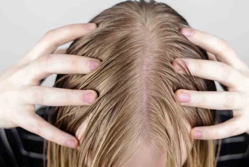 Close-up of a person's wet hair, showing scalp and widening part between the strands. Hands frame the head.