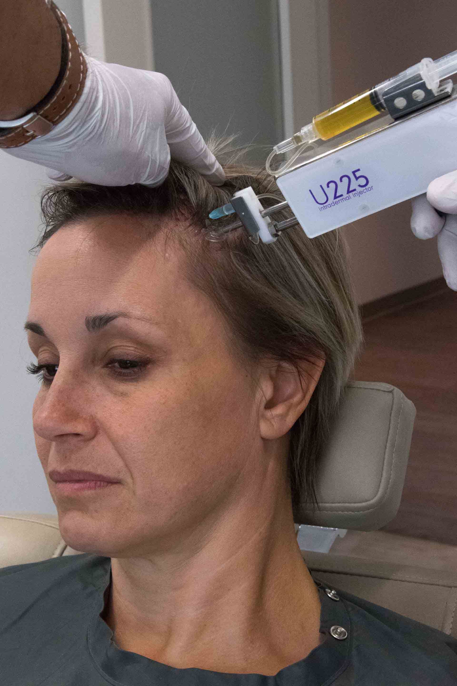 Person receiving a scalp injection from a clinician, reclining in a chair