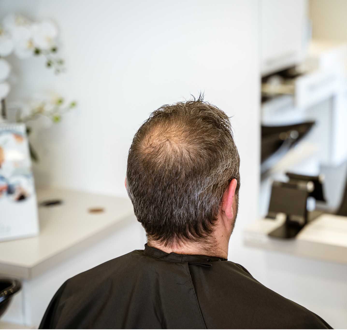 Man with thinning hair at a salon, wearing a black cape. Bright, modern setting.
