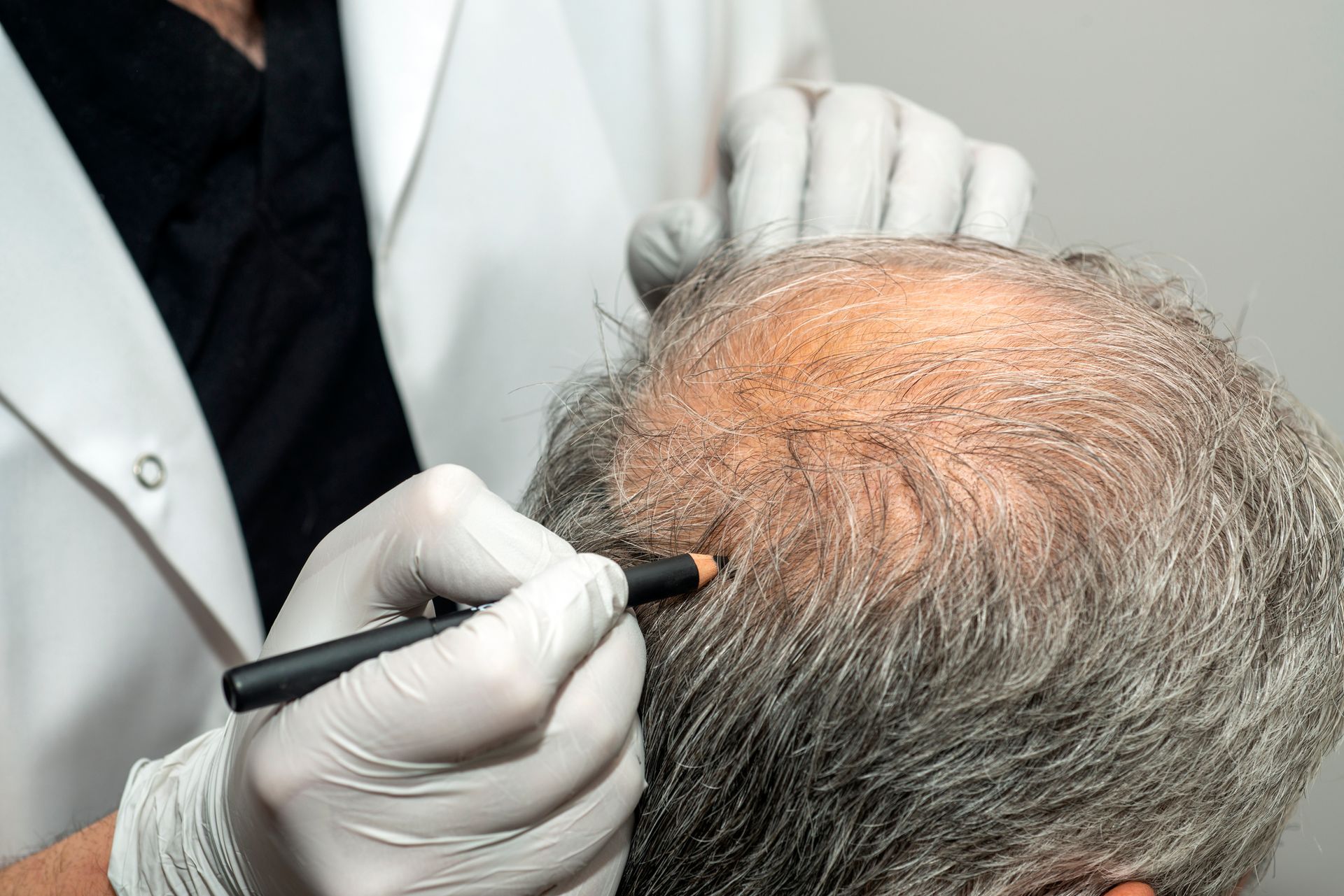 Medical worker examining a balding scalp with a handheld device