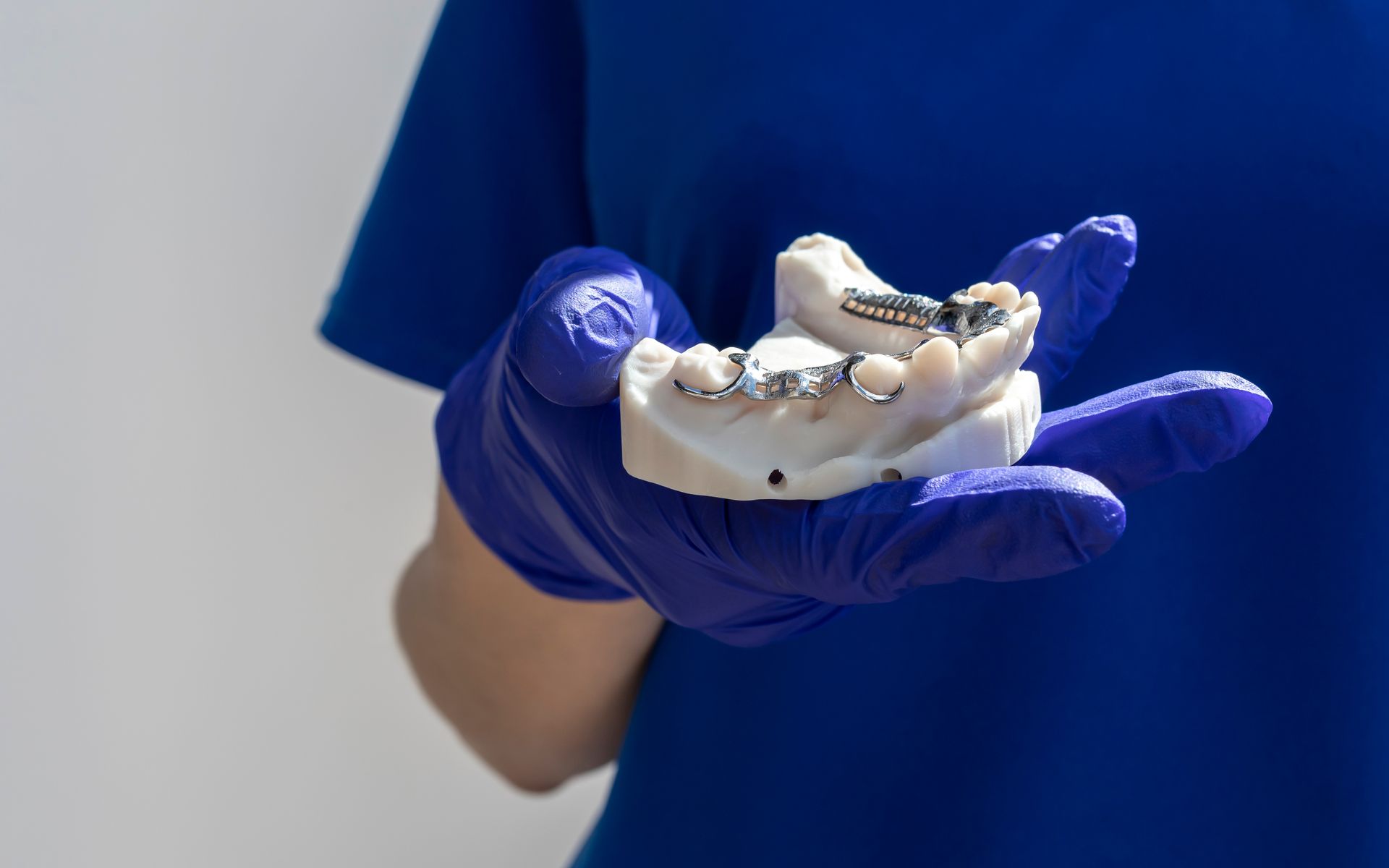 Blue-gloved hand holding a white dental mold with teeth and wax in a clinical setting
