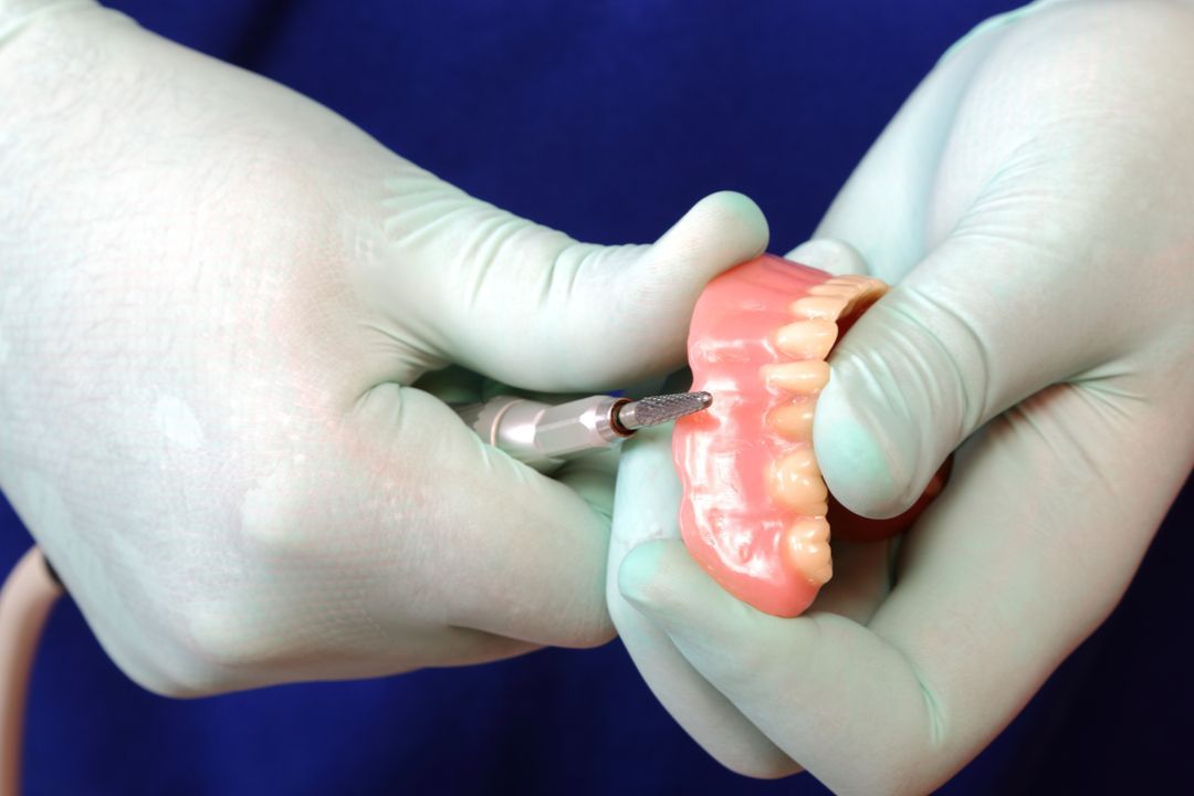 Gloved hands holding a dental mold with a metal clasp on a blue background