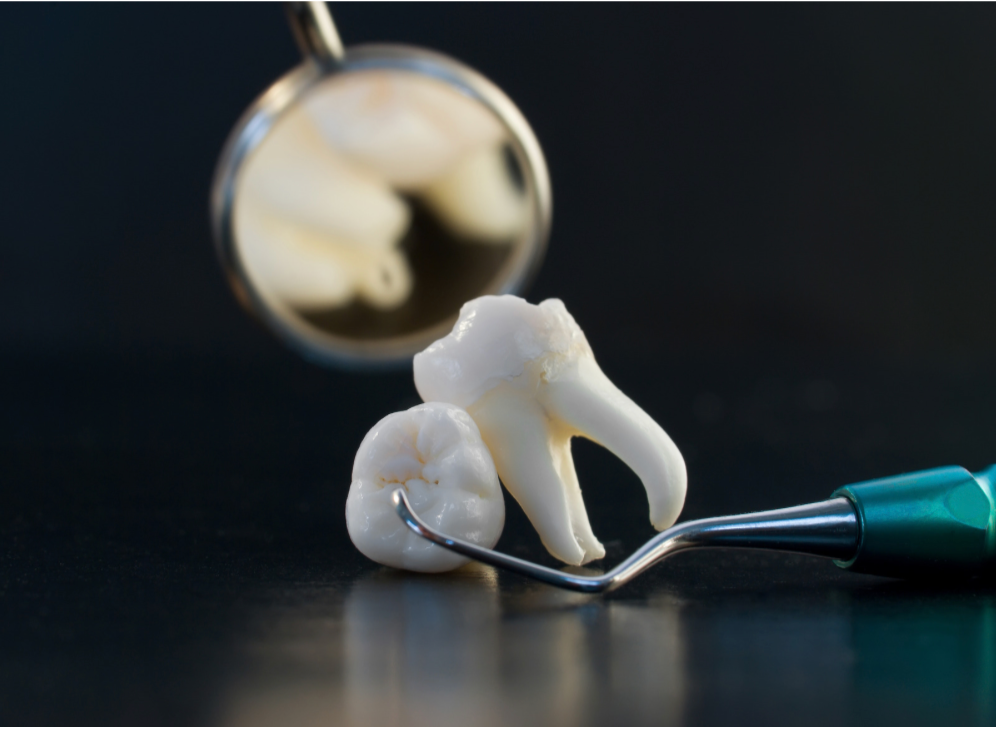 Tooth model on dental tool with blurred mirror in background