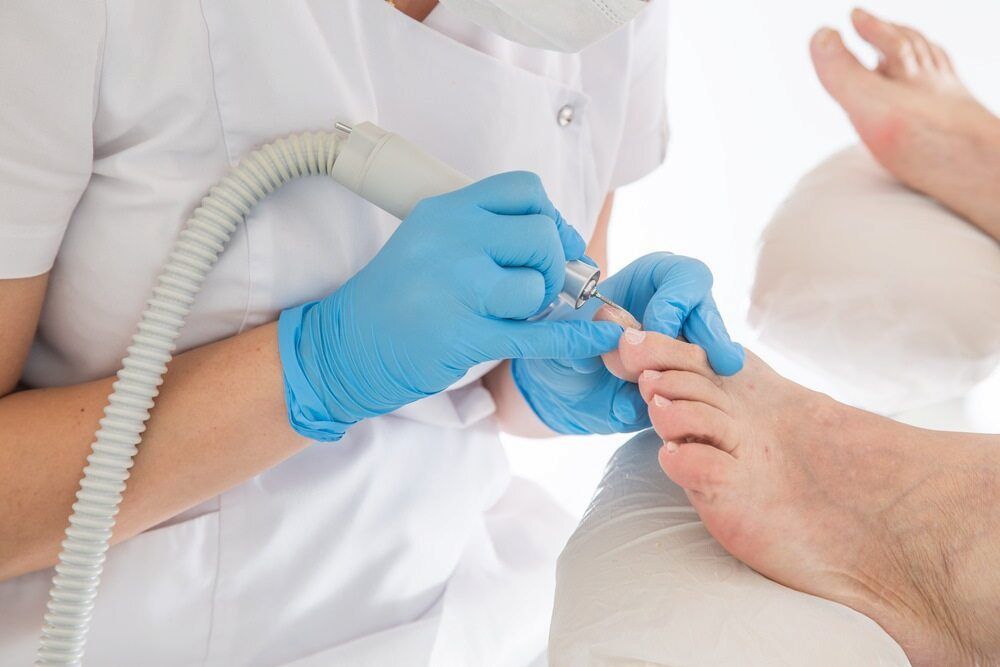 A Person Is Getting Their Toenails Done By A Podiatrist — Lake Macquarie Podiatry in Swansea, NSW