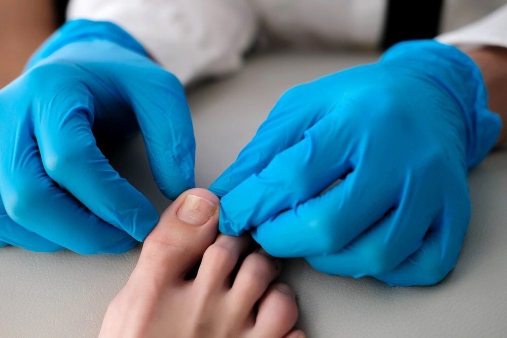 A Doctor Is Examining A Patient's Toenails With Blue Gloves — Lake Macquarie Podiatry in Rathmines, NSW