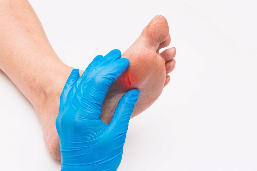 A Person Wearing Blue Gloves Is Examining A Person's Foot — Lake Macquarie Podiatry in Rathmines, NSW