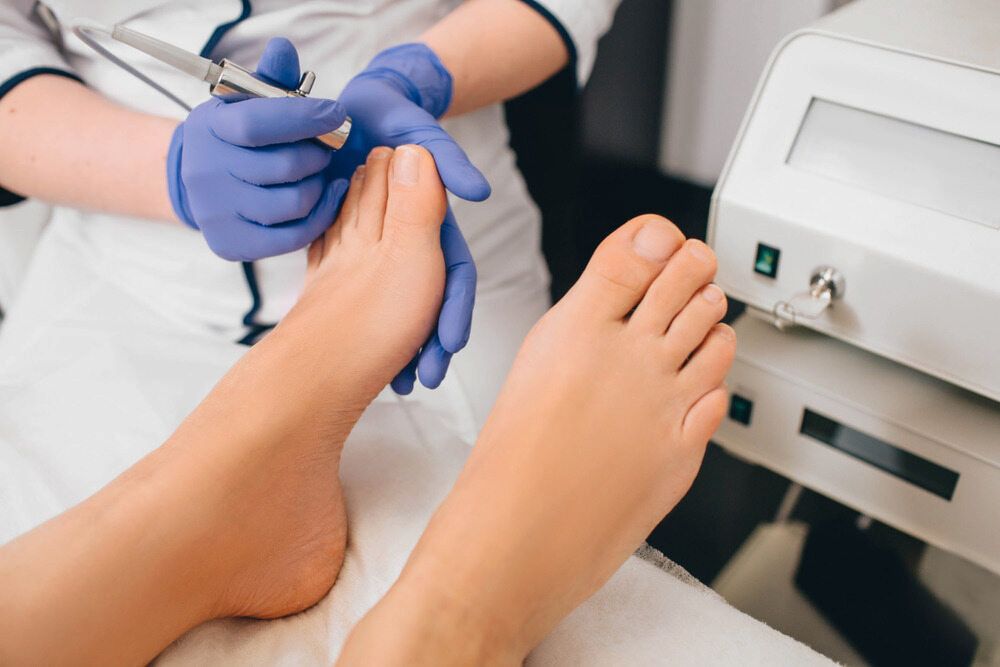 A Woman Is Getting Her Toenails Trimmed By A Podiatrist — Lake Macquarie Podiatry in Belmont, NSW