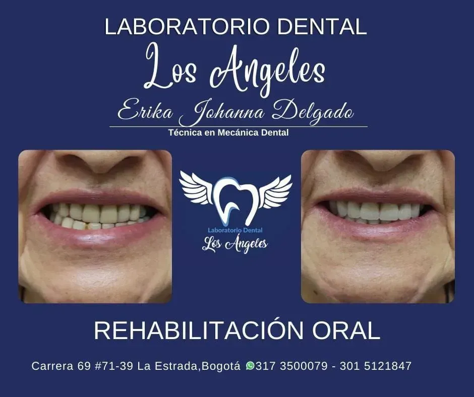 Anuncio de laboratorio dental en Los Ángeles: fotos de dientes antes y después sobre un fondo azul con el texto "rehabilitación oral".