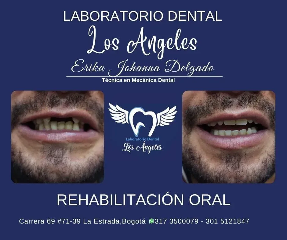 Anuncio de clínica dental en azul con fotos de antes y después de la boca y el texto: “Laboratorio Dental Los Ángeles” y “Rehabilitación oral”.