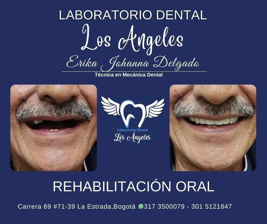 Anuncio de la clínica dental Laboratorio Dental Los Ángeles con fotos de antes y después de la sonrisa y datos de contacto.