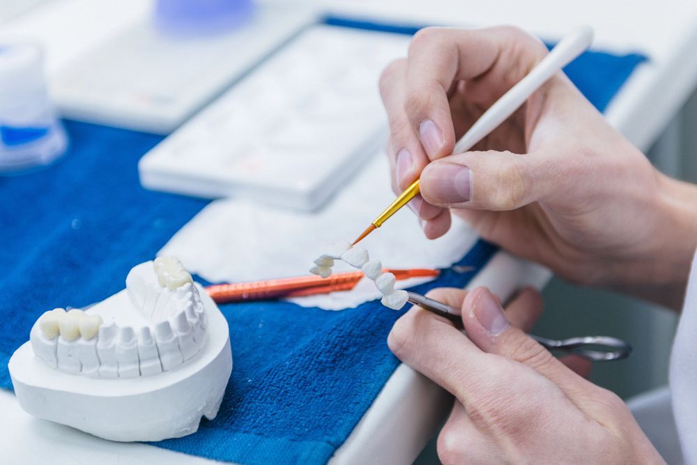 Dentista pintando un modelo dental con un pincel y una herramienta naranja sobre una toalla azul.