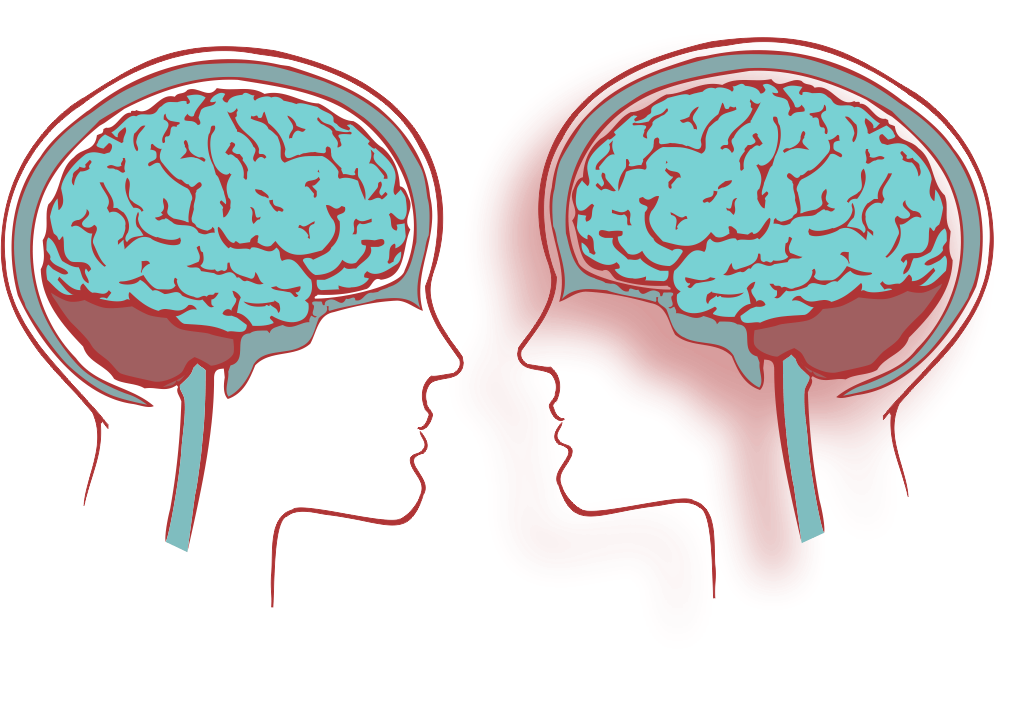 Facing Brains