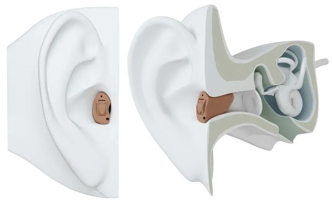 Diagram of an ear with a hearing aid placed behind it, shown in cross-section.