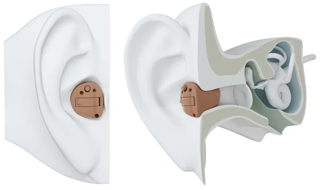 Hearing aid worn in an ear, shown outside and in a cutaway cross-section view
