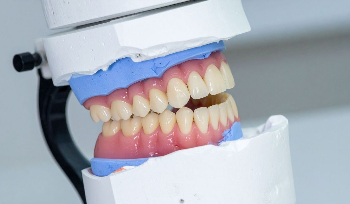 Dentures set on a model in a dental laboratory, pink gums with white teeth, held by a dental device.
