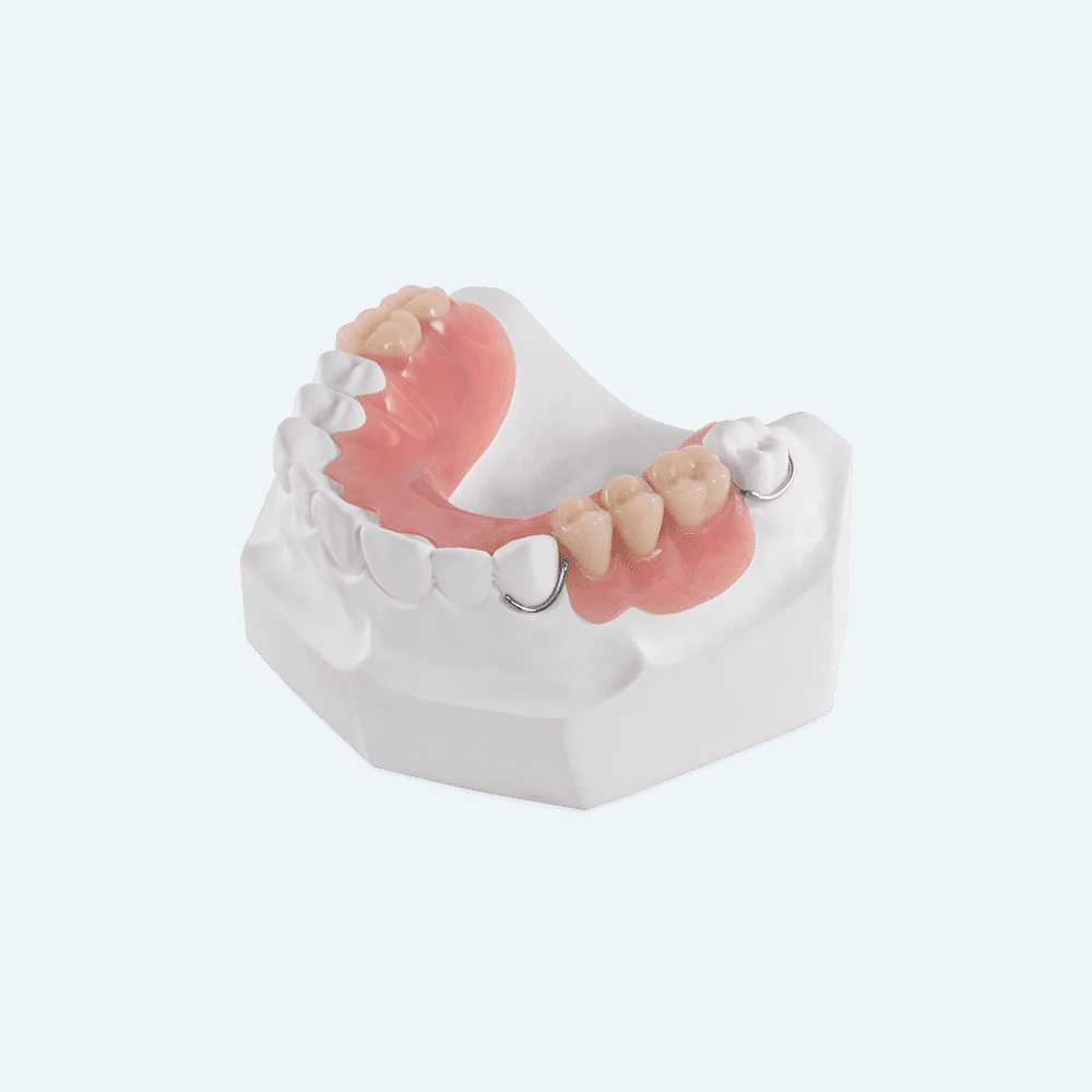 Partial dental prosthesis model on white plaster base. The pink gums have beige teeth.