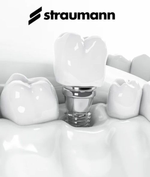 What makes Straumann implants different — Swiss system explained, Baro Dental Busan