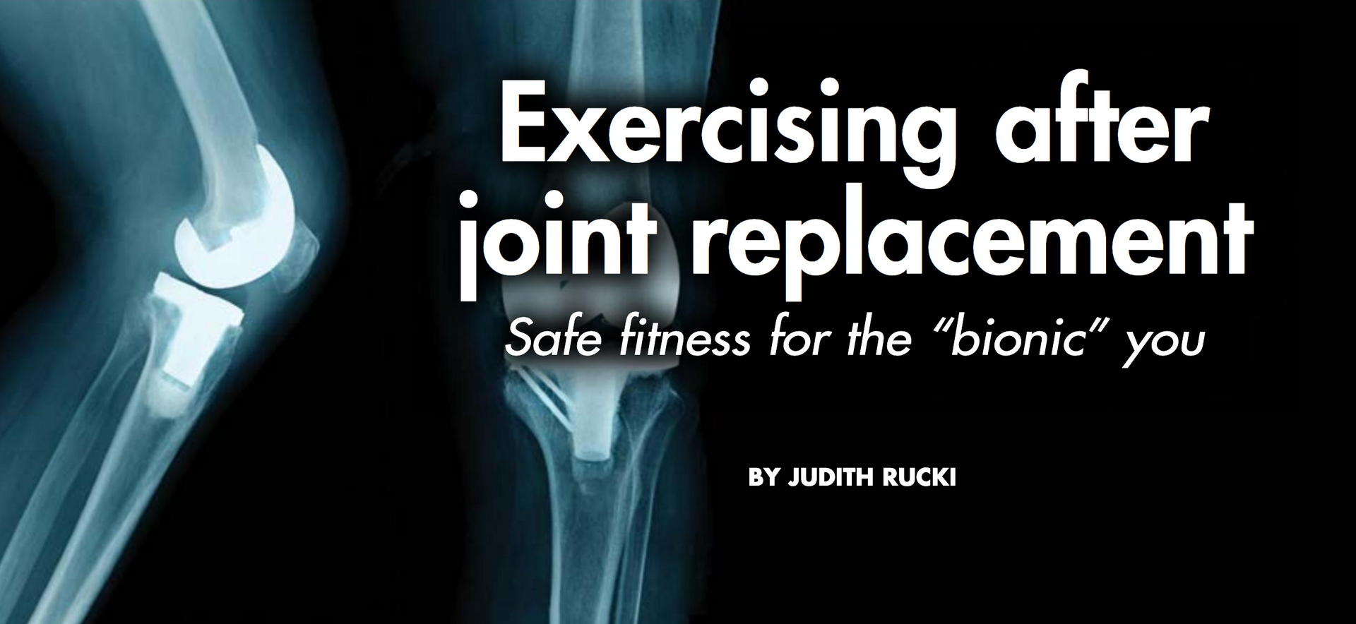 An article about exercising after joint replacement