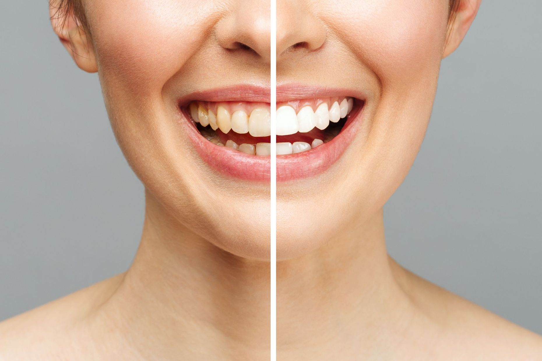 madre, nonna e figlia con denti bianchi