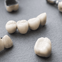 Dental crowns and bridges on a gray surface, showing a close-up of the false teeth, which are mostly white.