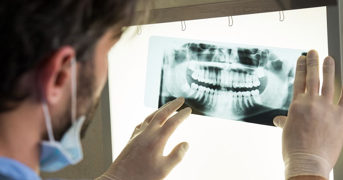 Dental Implants dentist, Dentist in Laurel MD