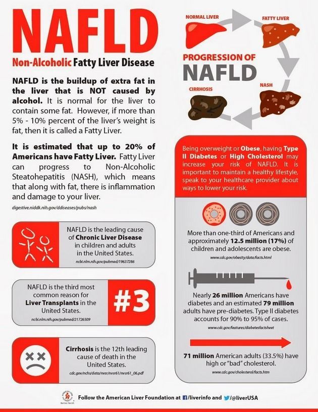 Infographic explaining NAFLD: definitions, progression stages, statistics on risks like obesity, diabetes, and cholesterol.